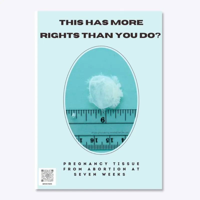 More Rights Than You?