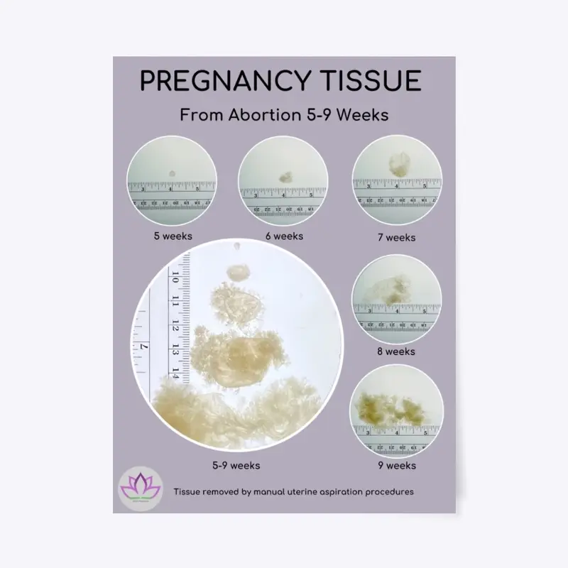 MYA Network Pregnancy Tissue Poster