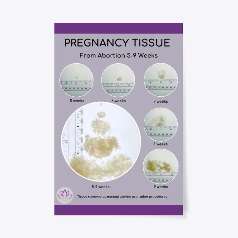 MYA Network Pregnancy Tissue Poster